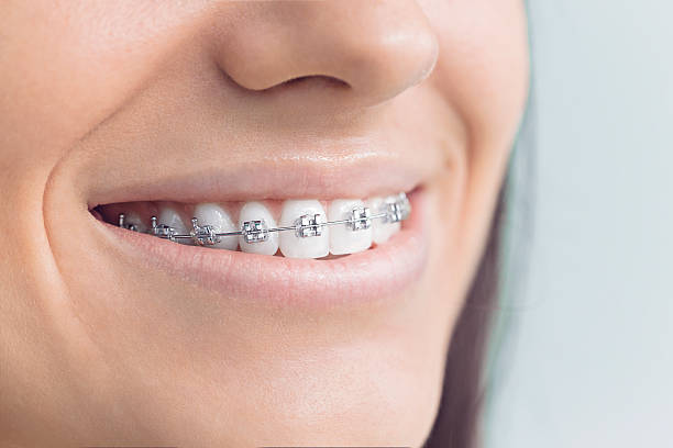 Best Dental Inlays and Onlays  in Hudson, FL